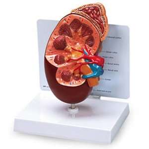  Nasco Kidney Model   Model WA21315HR   Each: Health 