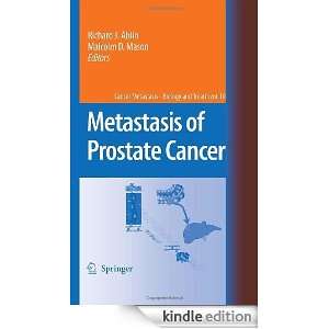   of Prostate Cancer (Cancer Metastasis   Biology and Treatment) 10