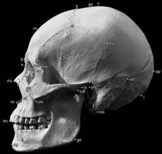 Bones and osteometric points of the human skull, lateral