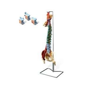 Muscle Spine Model with Disorders:  Industrial & Scientific