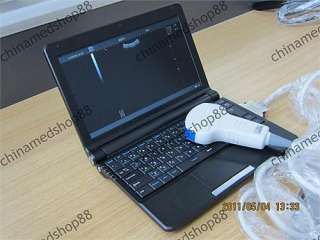 RUS 9000F2 laptop ultrasound scanner with 128 elements convex probe 